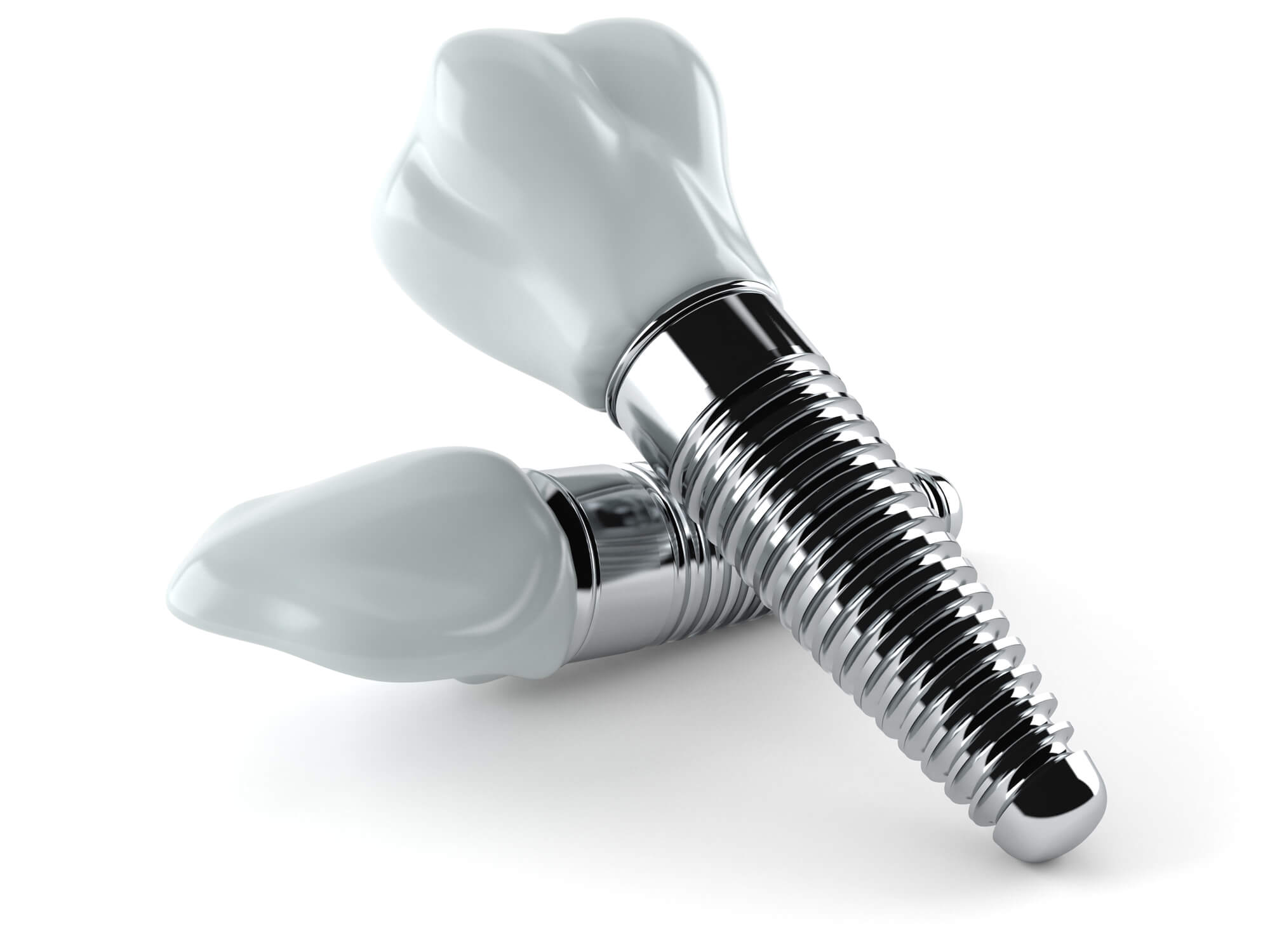 close up image of Dental Implants in Naples Florida 