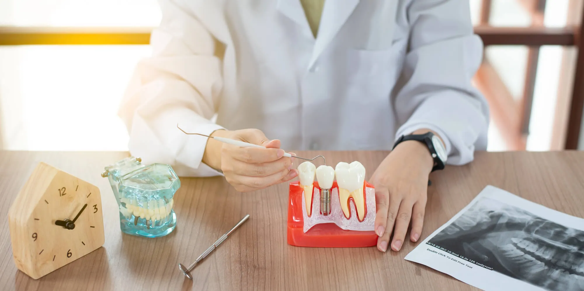 dentist explaining implant dentistry naples procedure