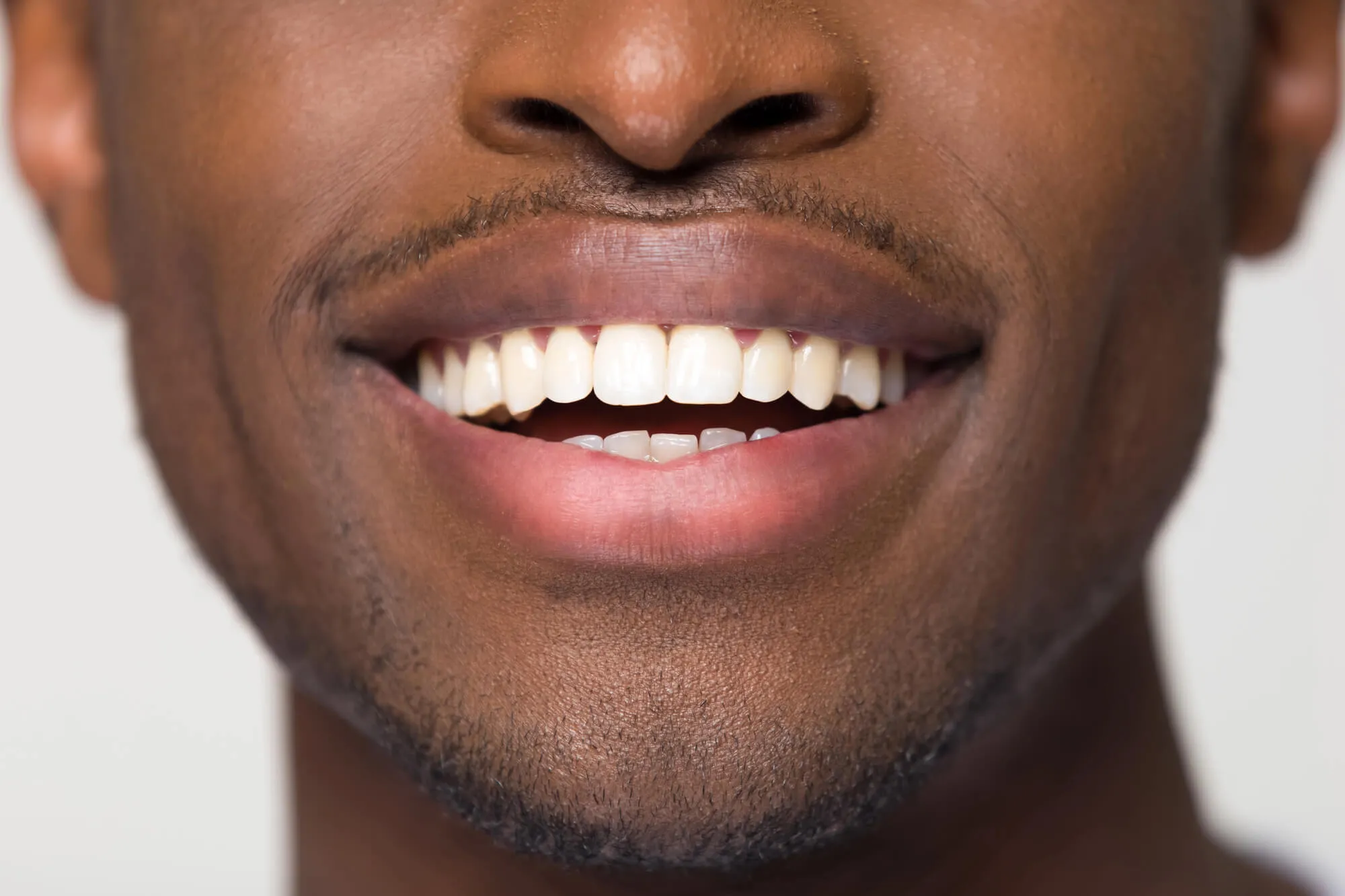 patient putting on dentures that have underwent denture repairs naples