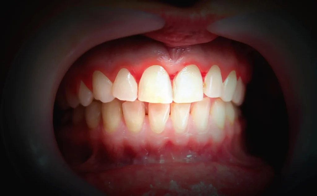 best dentists in naples checks gums