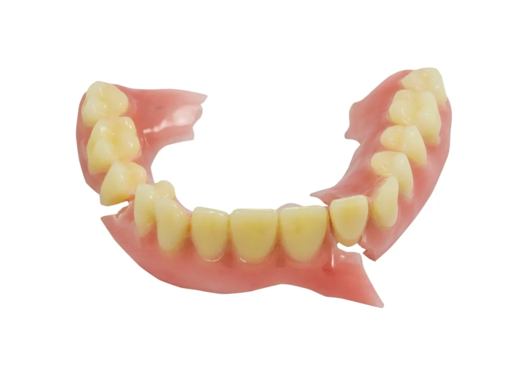 damage denture needs denture repairs naples