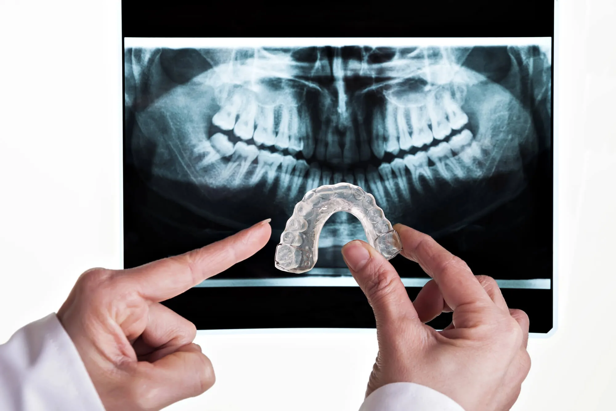 gulf coast dentist holding a night guard