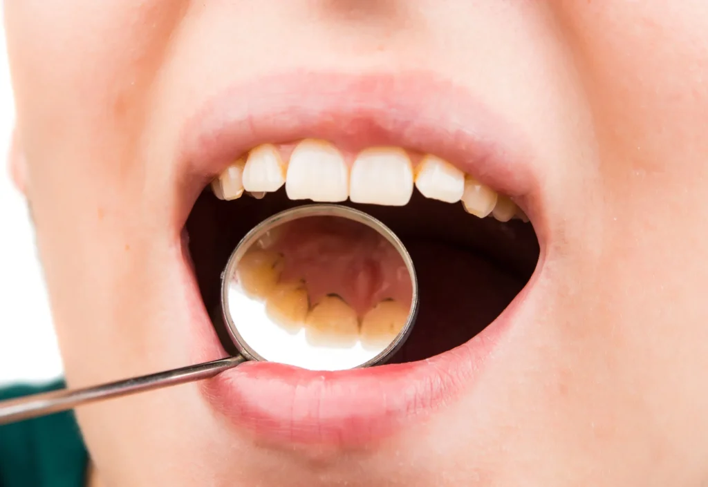 general dentistry naples dental exam