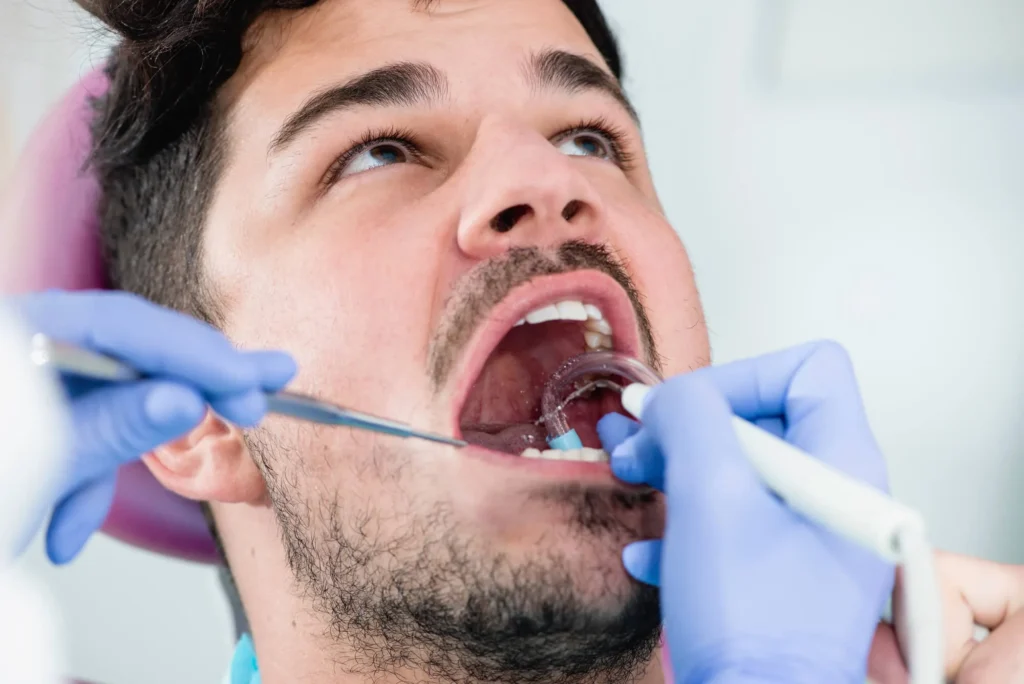 teeth cleaning naples