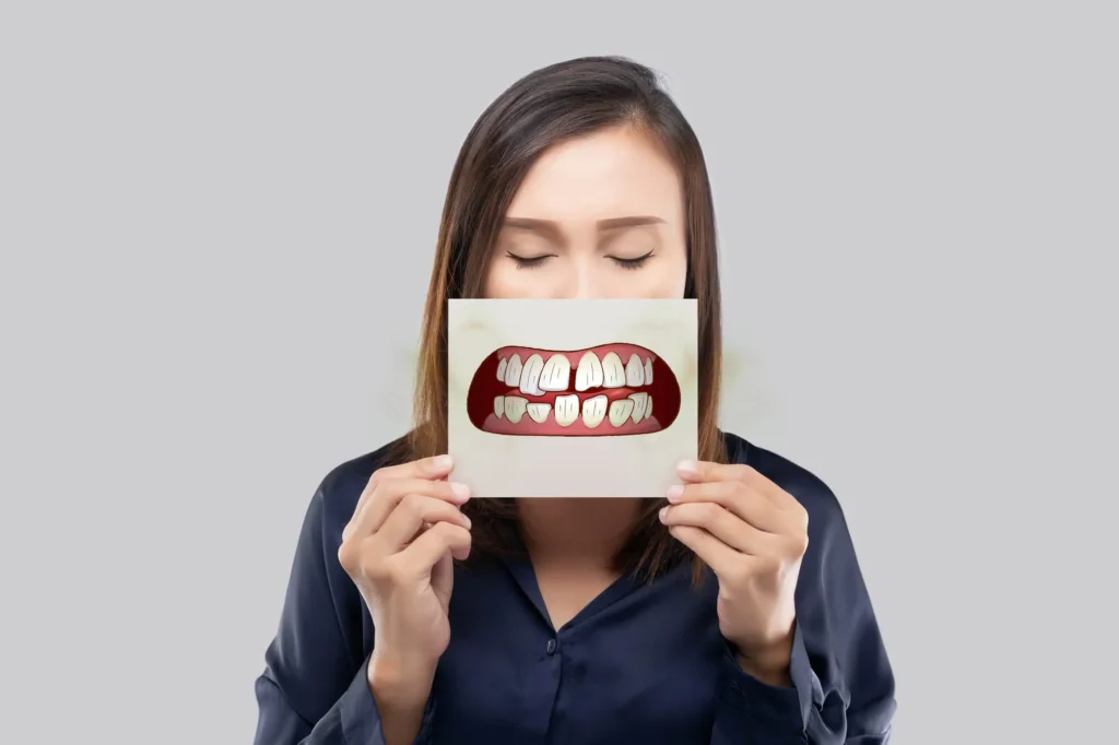 Have you ever had your teeth cleaned only to notice buildup returning sooner than expected? Tartar does not accumulate at the same rate for everyone. Two people can follow similar oral hygiene routines and still develop very different amounts of tartar between dental visits. Saliva, tooth position, plaque accumulation, and gum health can all influence how quickly deposits form. Through general dentistry in Naples, your dental team can assess your buildup and recommend preventive care based on what they see in your mouth.
What Can Affect How Quickly Tartar Forms?
Your Saliva Plays a Part
Tartar develops when dental plaque becomes mineralized. Saliva provides minerals involved in this process, but tartar formation depends on several factors. Research has found differences in certain salivary components between rapid and slow calculus formers, which may help explain why buildup develops faster for some people.
Tooth Position Can Make a Difference
Crowded or overlapping teeth can create areas where plaque is more difficult to clear. One study found greater dental crowding among rapid calculus formers, suggesting that tooth position may be one factor associated with increased buildup.
Certain Areas Are More Prone to Buildup
Tartar often develops near the openings of salivary ducts. This helps explain why deposits frequently appear behind the lower front teeth and around the outer surfaces of upper back teeth, even when the rest of the mouth appears relatively clean.
Gum Health May Influence What Your Dentist Finds
Faster calculus formation has also been associated with periodontal disease. Because hardened deposits provide a rough surface where additional plaque can collect, regular evaluation of both the teeth and gums remains important.
How Can General Dentistry in Naples Help Manage Tartar Buildup?
Developing tartar quickly does not automatically mean you have poor brushing habits. Your dentist can consider where deposits form, your gum health, and how quickly buildup returns when recommending a cleaning schedule.
At Gulfside Dental, preventive visits are tailored to your current oral health needs. Schedule an appointment with us to have your teeth and gums evaluated and to discuss a suitable schedule for professional care.